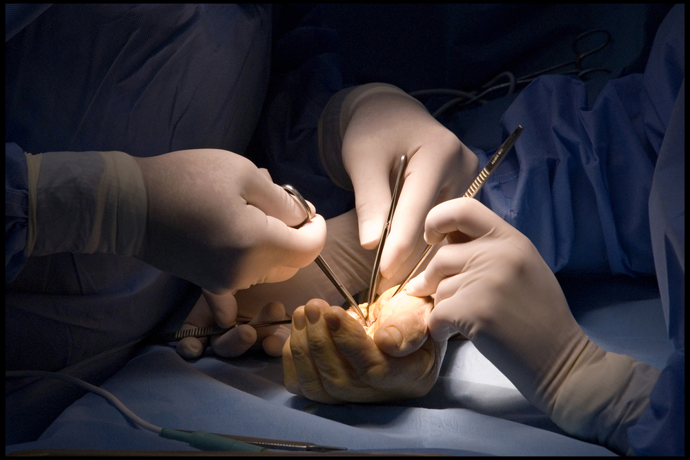 Hand Surgery in Qatar: Restoring Strength, Function, and Quality of Life